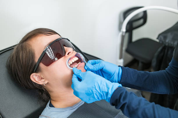 Teeth Whitening in CO